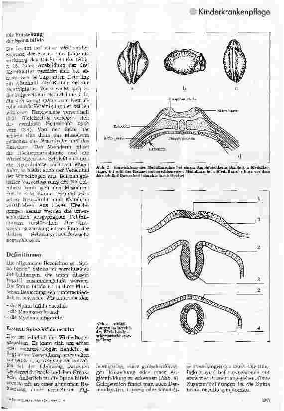 Vorschauseite 2: Kinderchirurgie Teil 2: Mißbildungen der Wirbelsäule und des Rückenmarks