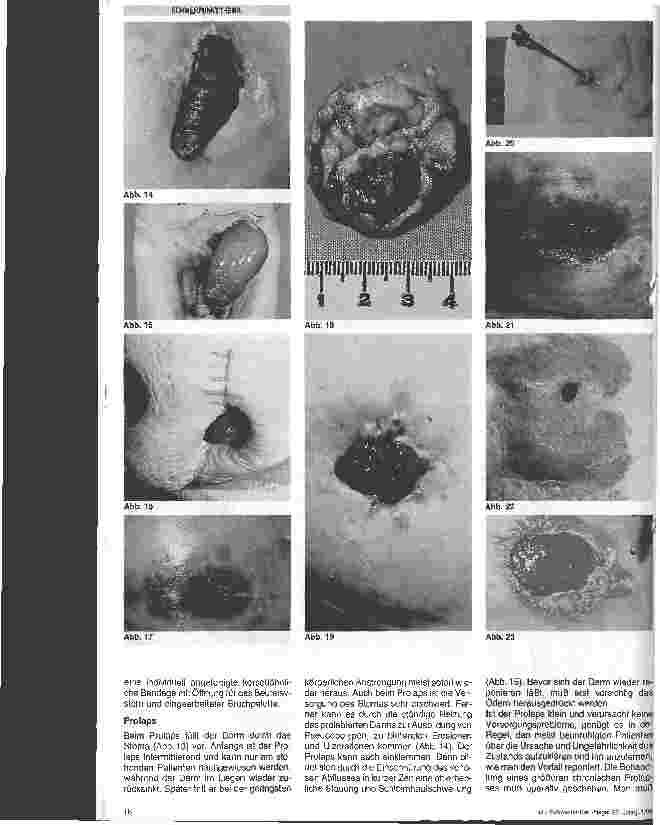 Vorschauseite 4: Das Stoma - Komplikationen und Therapie