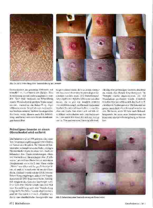 Vorschauseite 3: Chelidonium majus in der Therapie prämaligner Hautveränderungen