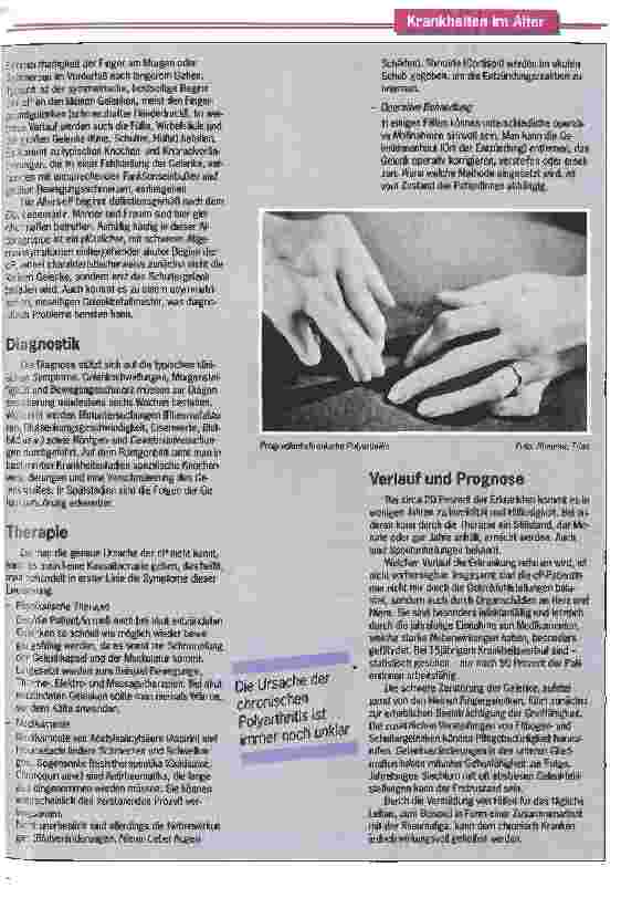 Vorschauseite 2: Typisch ist der schmerzhafte Händedruck Die chronische Polyarthritis beginnt oft an den Fingergrundgelenken
