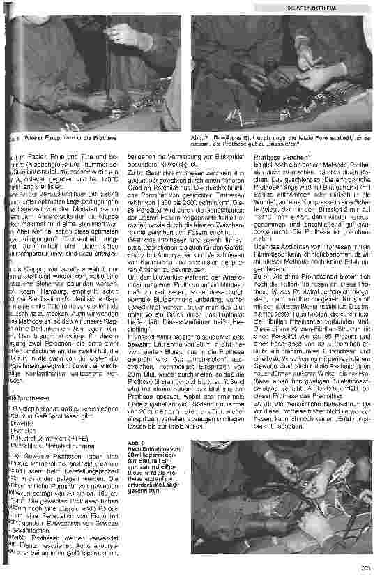 Vorschauseite 3: Umgang mit Implantationsmaterial