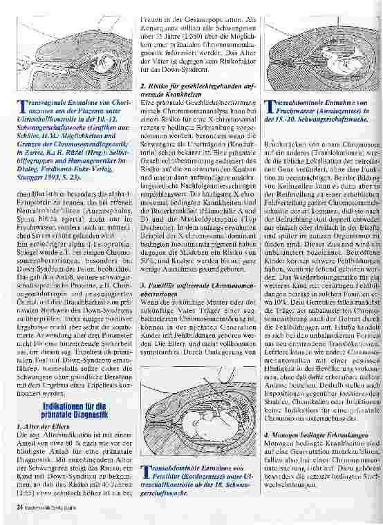 Vorschauseite 3: Pränatale Diagnostik Die Sicht der Humangenetik