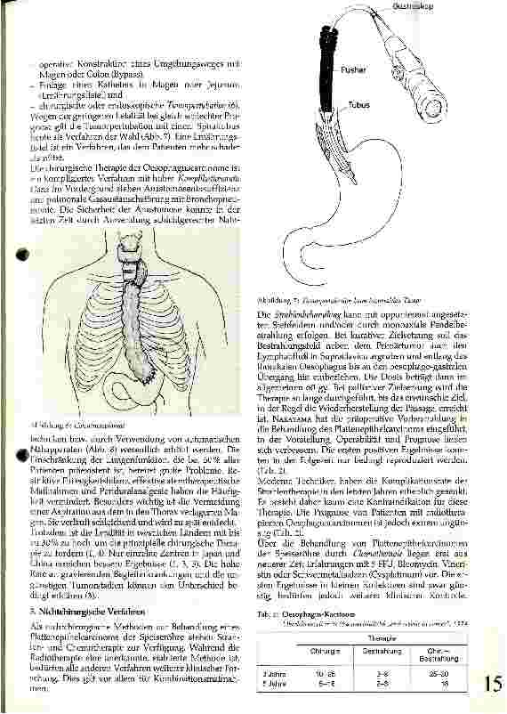 Vorschauseite 3: Die Therapie des Plattenepithelcarcinoms der Speiseröhre