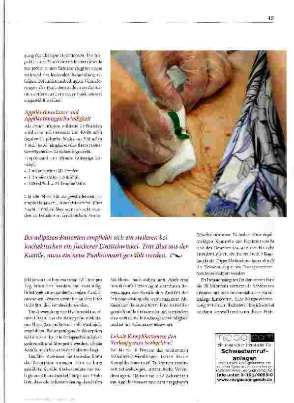 Vorschauseite 4: Subkutane Infusionen