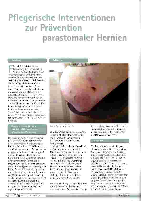 Vorschauseite 1: Pflegerische Intervention zur Prävention oarastomaler Hernien