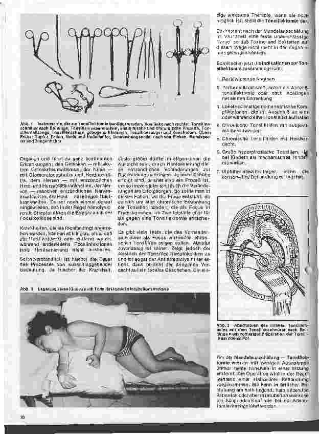 Vorschauseite 3: Einführung in die Hals - Nasen - Ohren - Heilkunde 15. Folge: Erkrankungen des lymphatischen Rachenringes (Teil 2)