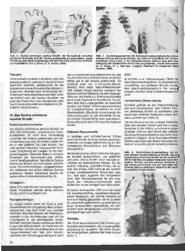 Vorschauseite 3: Das Herz 10.Folge:Angeborene Herzfehler, Klinik u.operative Therapie (III.Teil)