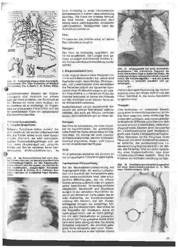 Vorschauseite 5: Das Herz 10.Folge:Angeborene Herzfehler, Klinik u.operative Therapie (III.Teil)