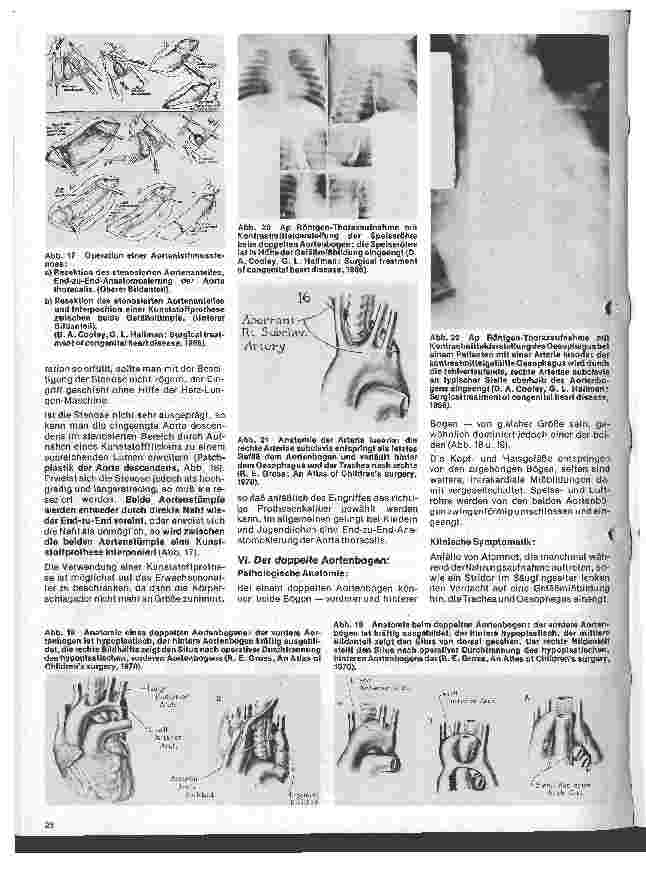 Vorschauseite 6: Das Herz 10.Folge:Angeborene Herzfehler, Klinik u.operative Therapie (III.Teil)