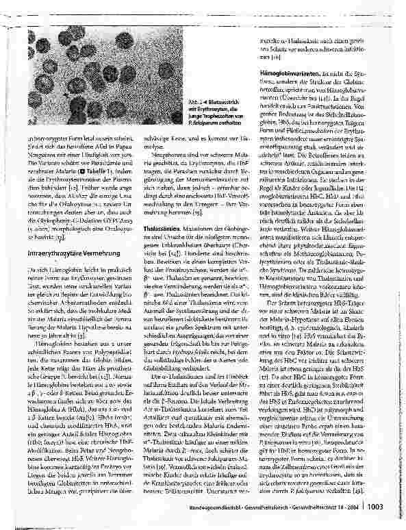 Vorschauseite 4: Einfluss genetischer Varianten des Menschen auf Resistenz und Immunität gegen Malaria