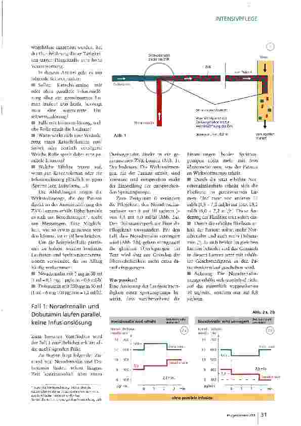 Vorschauseite 2: Gefährliche Schwankungen