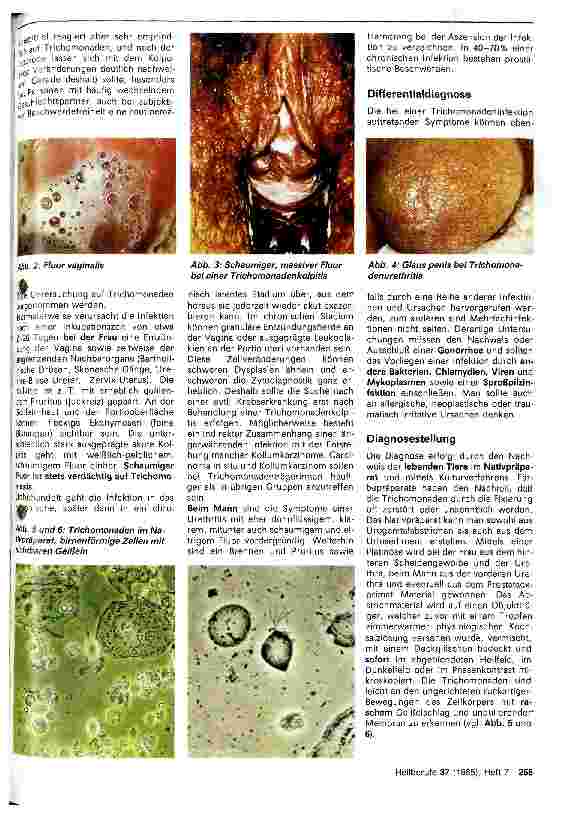 Vorschauseite 2: Trichomonadeninfektionen - Klinik und Therapie