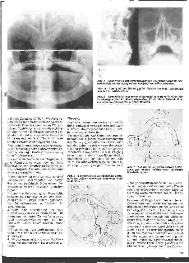 Vorschauseite 2: Zahn-, Mundund Kieferchirurgie 5. Folge: Klinik und Therapie retinierter Zähne