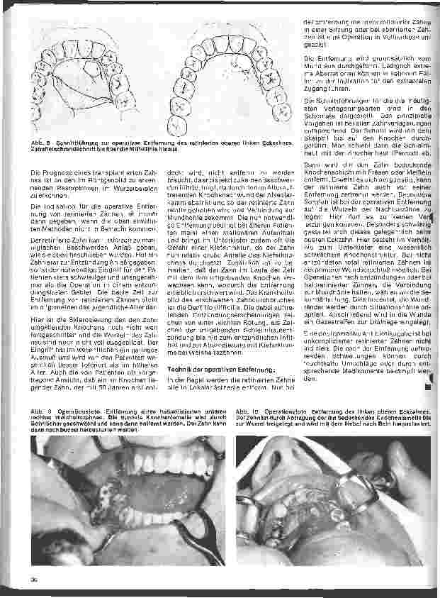 Vorschauseite 3: Zahn-, Mundund Kieferchirurgie 5. Folge: Klinik und Therapie retinierter Zähne