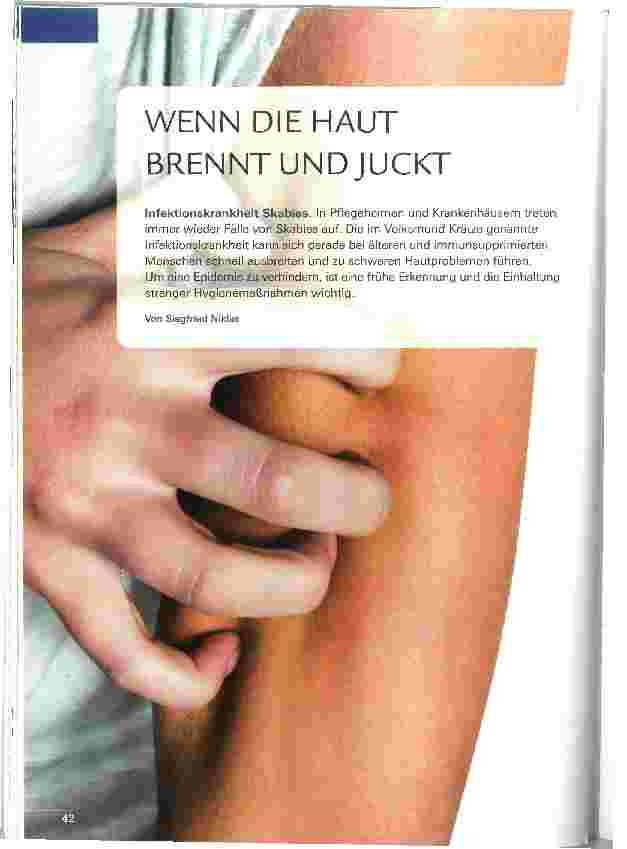 Vorschauseite 1: WENN DIE HAUT BRENNT UND JUCKT