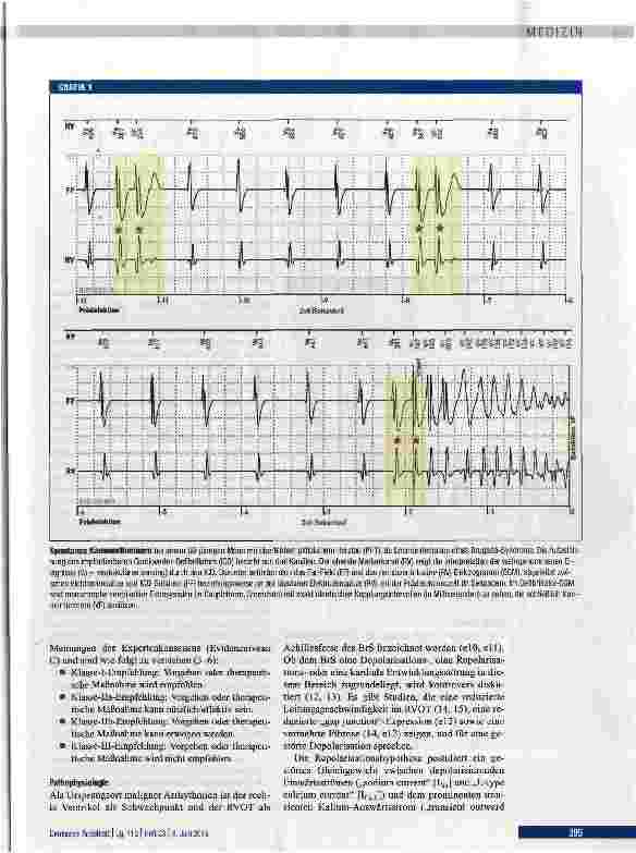 Vorschauseite 2: Diagnose, Risikostratifizierung und Therapie des Brugada-Syndroms