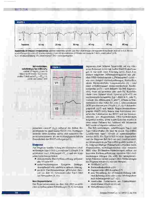 Vorschauseite 3: Diagnose, Risikostratifizierung und Therapie des Brugada-Syndroms