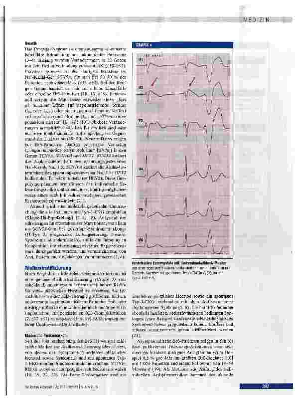 Vorschauseite 4: Diagnose, Risikostratifizierung und Therapie des Brugada-Syndroms