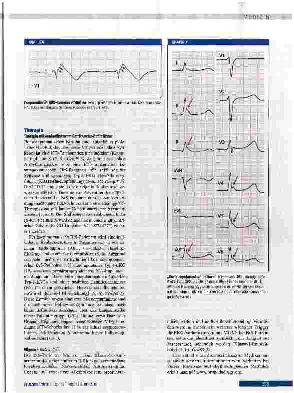 Vorschauseite 6: Diagnose, Risikostratifizierung und Therapie des Brugada-Syndroms
