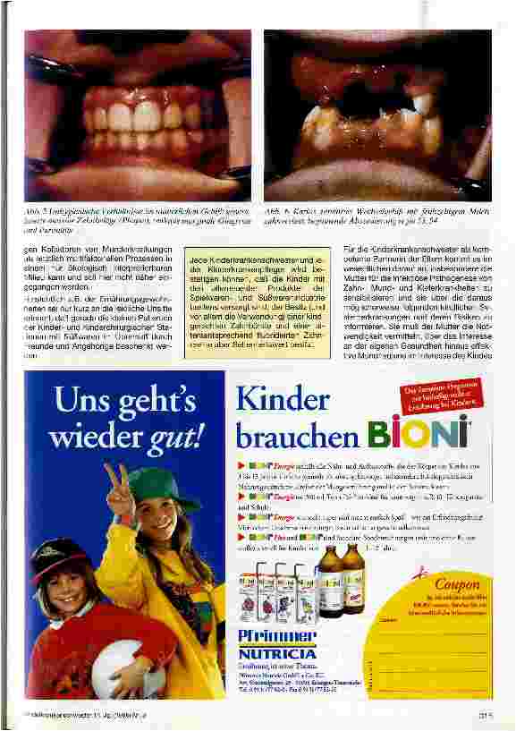 Vorschauseite 4: Intrafamiliäre orale Infektion durch Streptokokkus mutans Ein Beitrag zur Oralprophylaxe durch die Kinderkrankenschwester