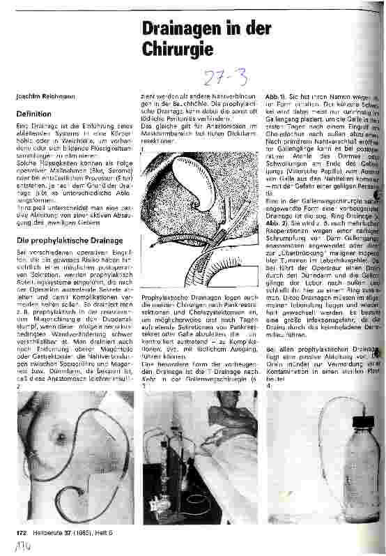 Vorschauseite 1: Drainagen in der Chirurgie