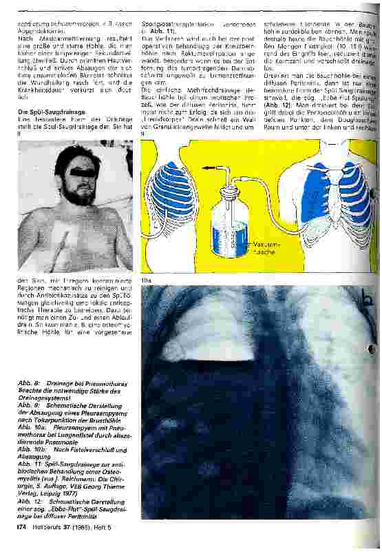Vorschauseite 3: Drainagen in der Chirurgie