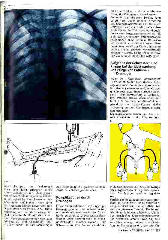 Vorschauseite 4: Drainagen in der Chirurgie
