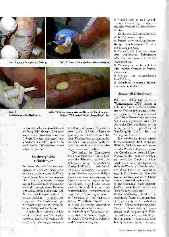 Vorschauseite 3: SECHS ARTEN DES DEBRIDEMENTS