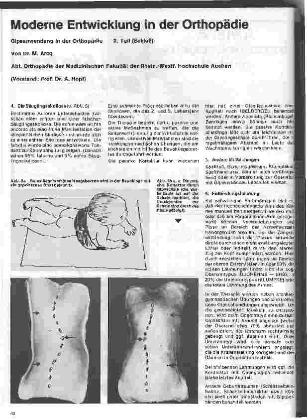 Vorschauseite 1: Moderne Entwicklung in der Orthopädie 2. Teil (Schluß): Gipsanwendung in der Orthopädie