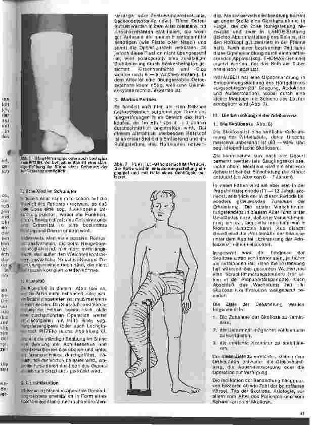 Vorschauseite 2: Moderne Entwicklung in der Orthopädie 2. Teil (Schluß): Gipsanwendung in der Orthopädie