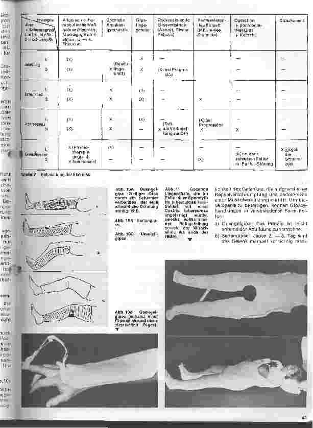 Vorschauseite 4: Moderne Entwicklung in der Orthopädie 2. Teil (Schluß): Gipsanwendung in der Orthopädie
