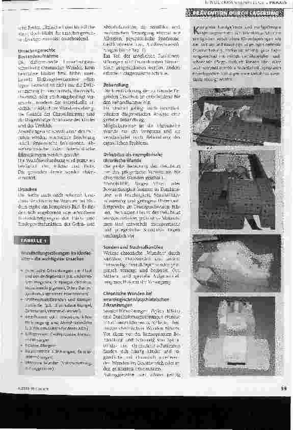 Vorschauseite 2: Chronische Wunden im Kindesalter