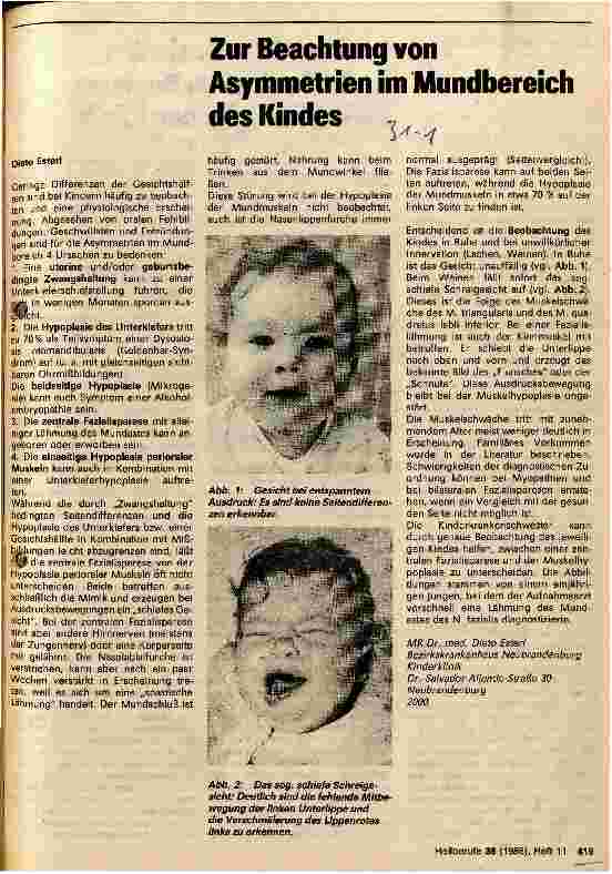 Vorschauseite 1: Zur Beachtung von Asymmetrien im Mundbereich des Kindes