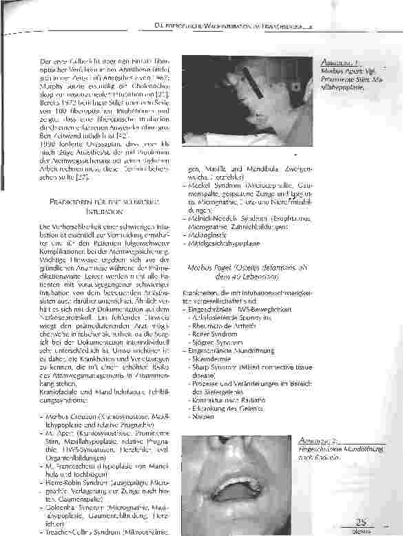 Vorschauseite 2: DIE FIBEROPTISCHE WACH INTUBATION IMERWACHSENENALTER