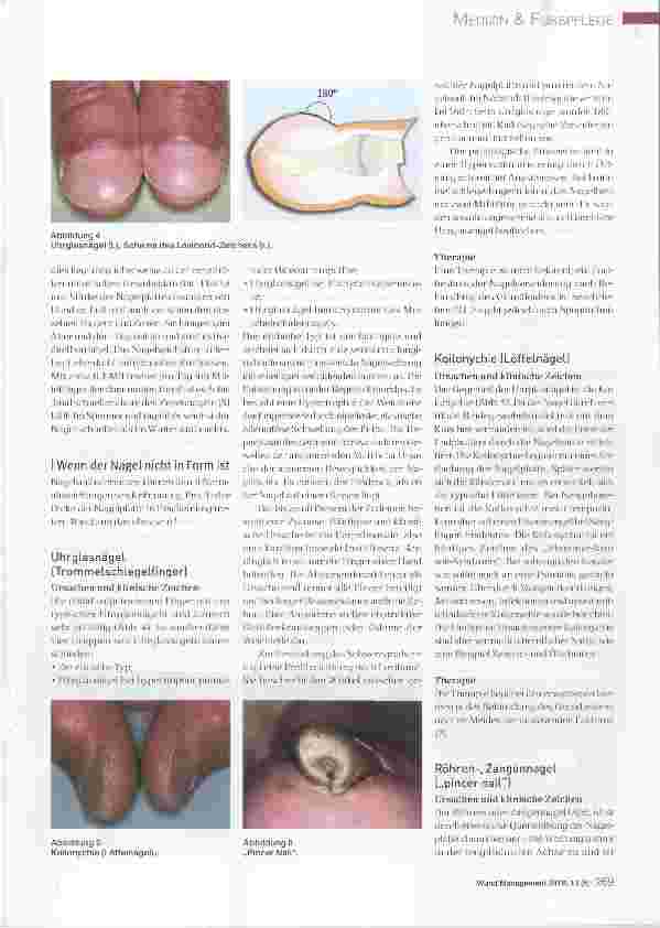 Vorschauseite 2: Ursachen und Therapie von Nagelerkrankungen