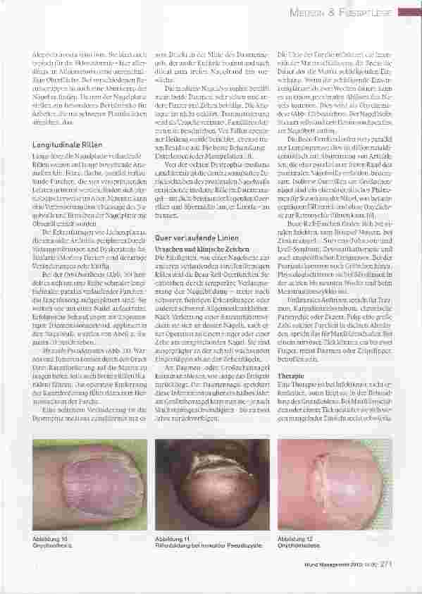 Vorschauseite 4: Ursachen und Therapie von Nagelerkrankungen