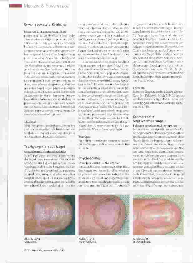 Vorschauseite 5: Ursachen und Therapie von Nagelerkrankungen