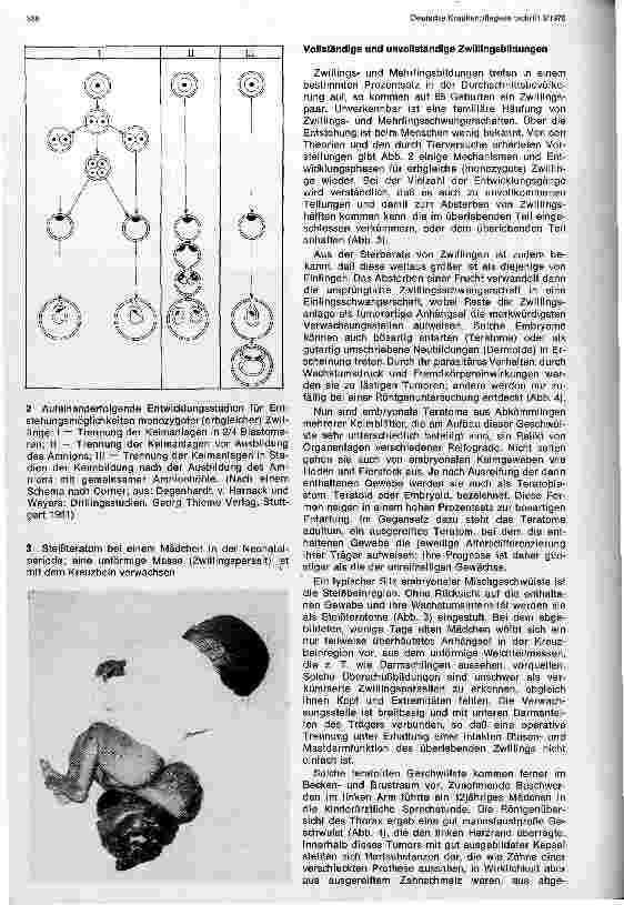 Vorschauseite 2: Embryonale Tumoren und verkümmerte Zwillingsbildungen