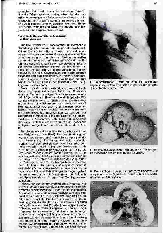 Vorschauseite 3: Embryonale Tumoren und verkümmerte Zwillingsbildungen