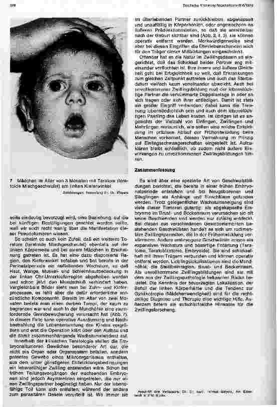 Vorschauseite 4: Embryonale Tumoren und verkümmerte Zwillingsbildungen