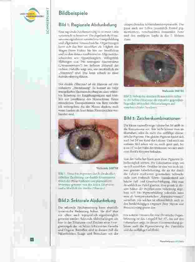 Vorschauseite 3: Chronische Krankheiten - „chronische“ Zeichen Welchen Beitrag kann die Augendiagnose leisten?