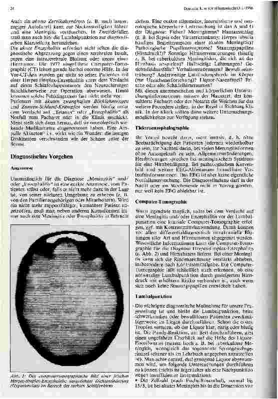 Vorschauseite 3: Die akuten Hirnund Hirnhautentzündungen Enzephalitis - Meningitis - Menigoezephalitis