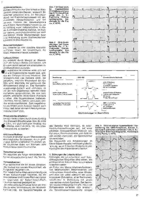 Vorschauseite 4: Das Herz 18. Folge: Postoperative Komplikationen nach Herzoperationen (II Teil)