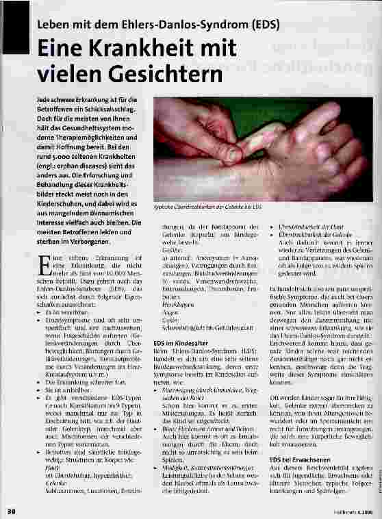 Vorschauseite 1: Eine Krankheit mit vielen GesichternLeben mit dem Ehlers-Danlos-Syndrom (EDS)