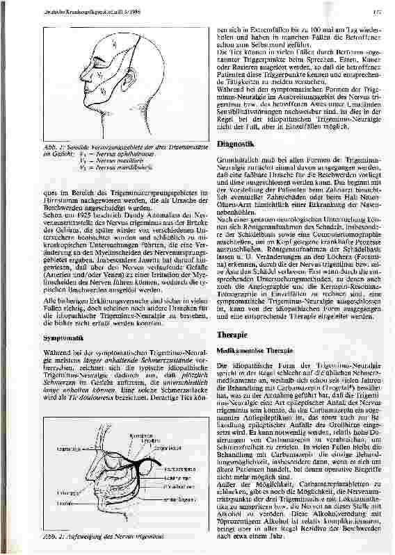 Vorschauseite 2: Trigeminus-Neuralgie