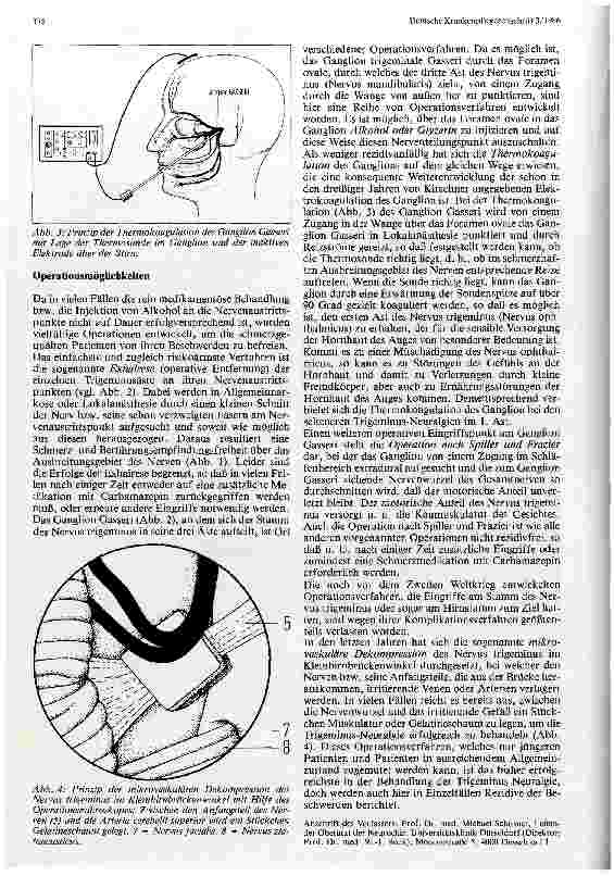 Vorschauseite 3: Trigeminus-Neuralgie