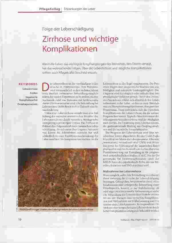 Vorschauseite 1: Folge der Leberschädigung Zirrhose und wichtige Komplikationen
