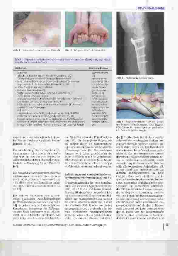 Vorschauseite 2: Die Implantatentfernung - eine Risiko-Nutzen-Abwägung?
