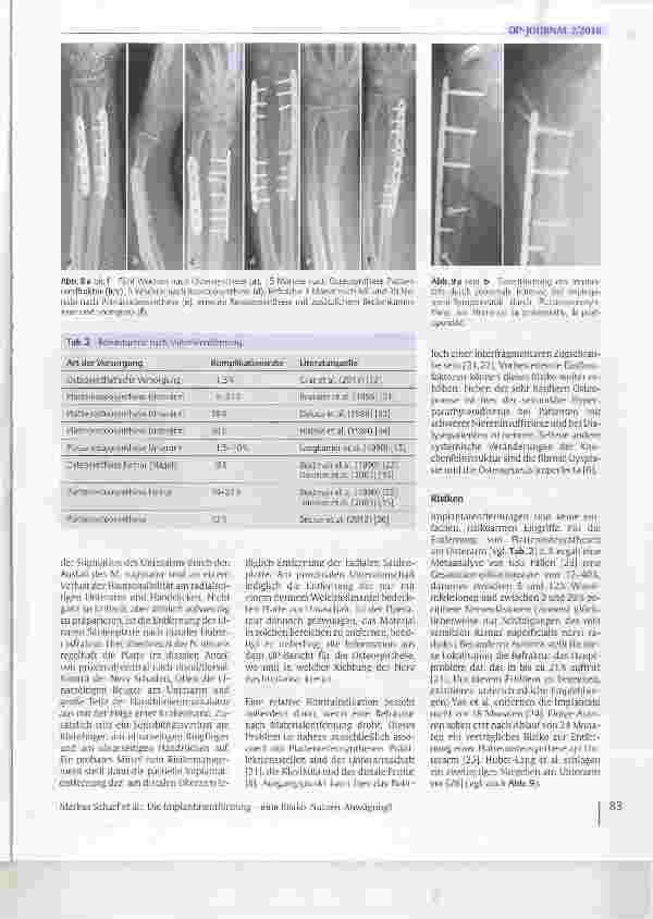 Vorschauseite 4: Die Implantatentfernung - eine Risiko-Nutzen-Abwägung?