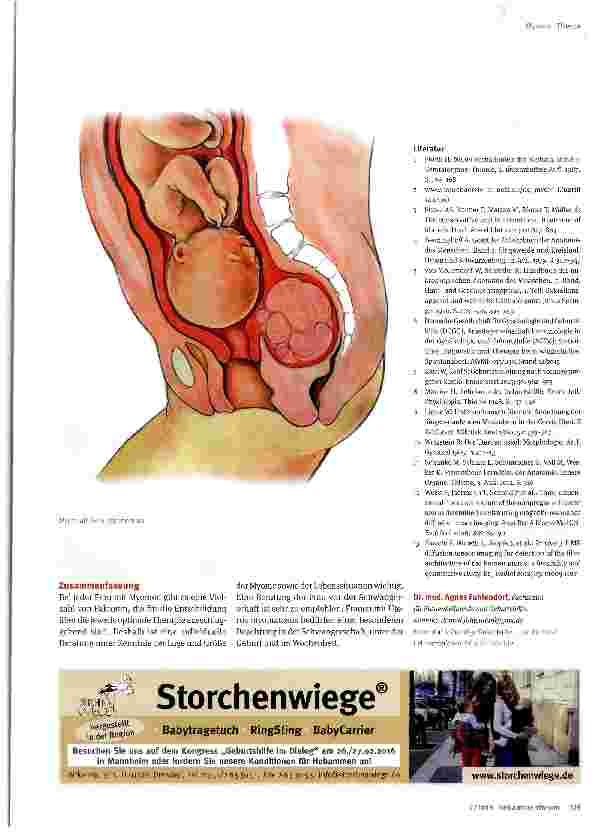 Vorschauseite 4: Gutartige Muskelknoten - ist das alles?